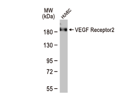 VEGF Receptor 2 antibody (GTX129943)