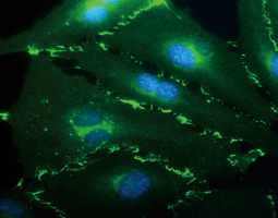 VE-Cadherin antibody [GT1369] (GTX633705)