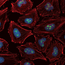 CDKN2A / p14ARF antibody (GTX129903)