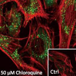 SQSTM1 / P62 antibody [N3C1], Internal 
(GTX100685)