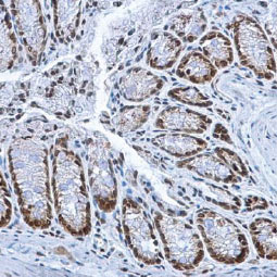 HMGB1 antibody
(GTX101277)