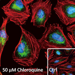 NDP52 antibody (GTX115378)