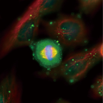 Aurora A antibody [C3], C-term (GTX104620)