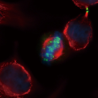 Aurora B antibody (GTX132702)