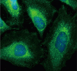 ACAA1 antibody  (GTX114229)