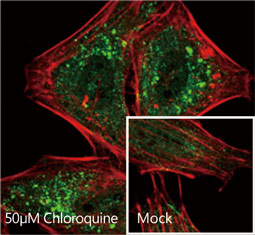 ATG5 antibody  (GTX113309)