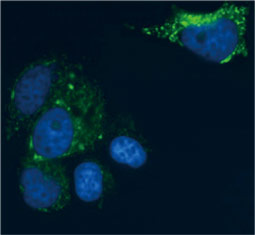 CD81 antibody  (GTX101766)