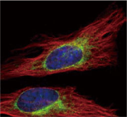 Calnexin antibody (GTX109669)