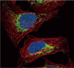 Citrate synthetase antibody (GTX110624)