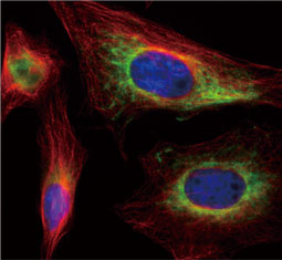 Cytokeratin 18 antibody (GTX112977)