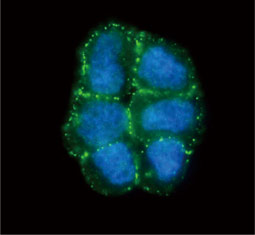 Desmoglein 2 antibody  (GTX102508)