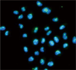 EIF6 antibody (GTX54010)