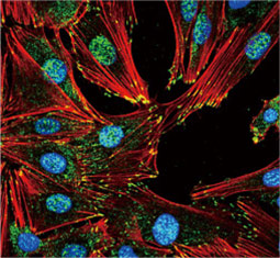 FAK (phospho Try407) antibody (GTX132320)