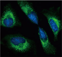 Grp78 antibody (GTX113340)