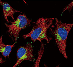 LAMP1 antibody  (GTX634336)