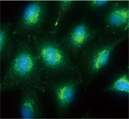 LAMP2 antibody  (GTX103214)