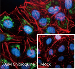 LC3B antibody  (GTX127375)