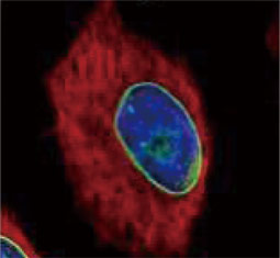 Lamin A + C antibody  (GTX101127)