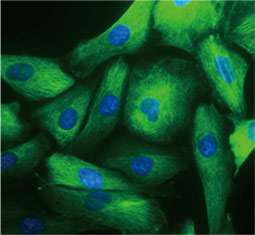 Nestin antibody (GTX630201)