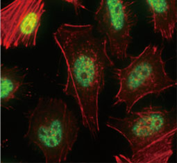 Nuclear Matrix Protein p84 antibody (GTX70220)