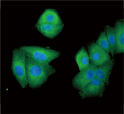 PEX19 antibody  (GTX110721)