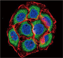 PSMB6 antibody  (GTX23331)