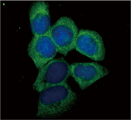 PSMD2 antibody (GTX102289)