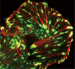 Paxillin antibody (GTX125891)