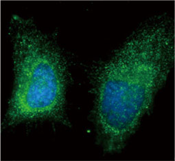 RAB11B antibody  (GTX119095)