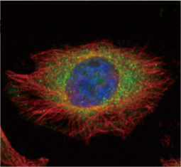 RPS6 antibody  (GTX113542)