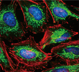 SDHA antibody (GTX632636)