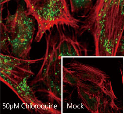 SQSTM1 antibody (GTX100685)