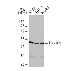 TSG101 antibody  (GTX70255)