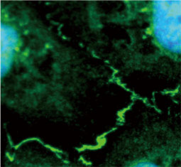 ZO-1 antibody  (GTX108627)