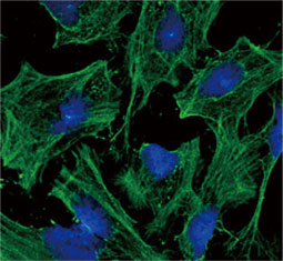 beta Actin antibody (GTX629630)