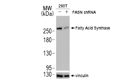 Fatty Acid Synthase antibody