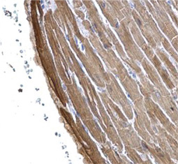 Cardiac Troponin I antibody [N1C3] GTX109331