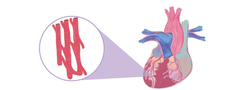 Cardiomyocytes