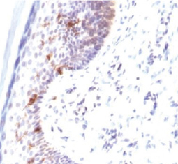 CD1a antibody GTX134471