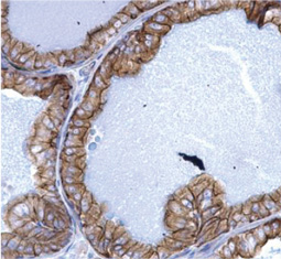 Cytokeratin 5 antibody GTX113219