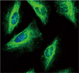 Vimentin antibody
(GTX100619)