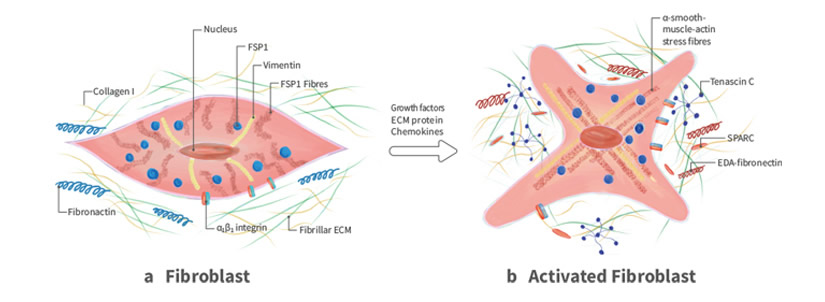 Fibroblasts