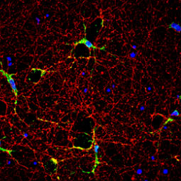 iNOS antibody (GTX130246)