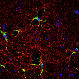 iNOS antibody (GTX130246)