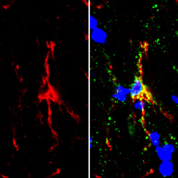 TMEM119 antibody (GTX134087)