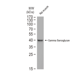 gamma Sarcoglycan antibody