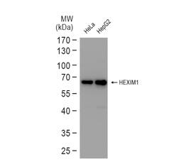 Transgelin antibody (GTX101608)