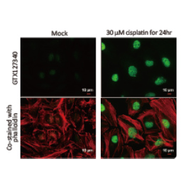 Histone H2A.XS139ph (phospho Ser139) antibody (GTX127340)