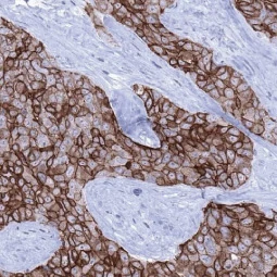 TACSTD2 antibody [MSVA-733R] HistoMAX (GTX04443) 