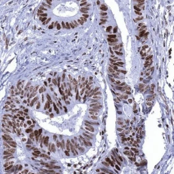 MSH6 antibody [MSVA-906R] HistoMAX (GTX04416)